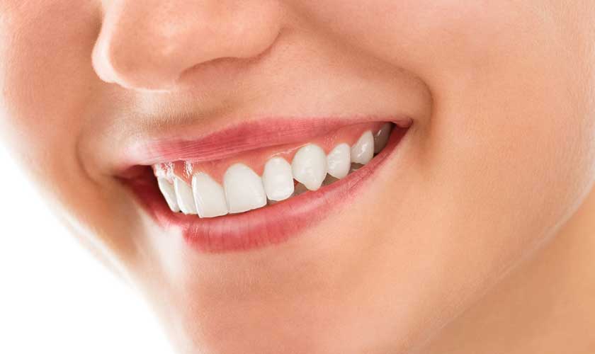 Teeth Whitening Cost And Benefits