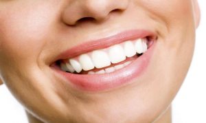 teeth whitening treatment