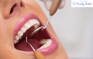 Root Canal Treatment in Oak Forest