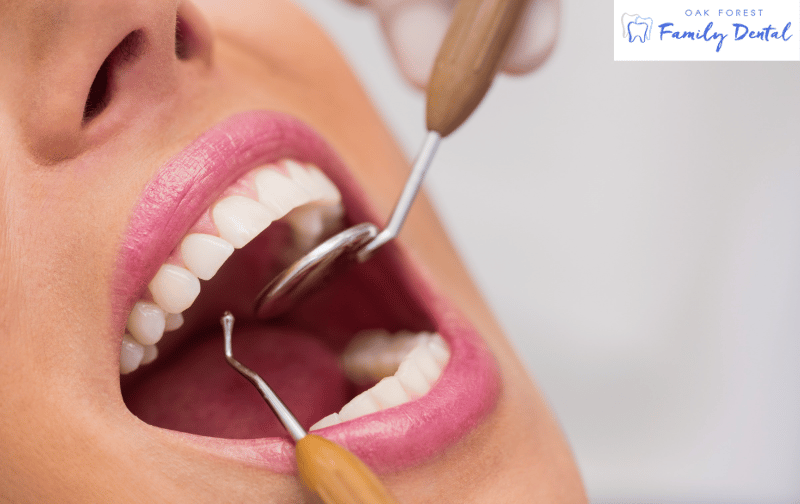 Root Canal Treatment in Oak Forest