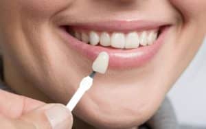 Cosmetic Dentistry - Advanced Solutions Family Dental, IL