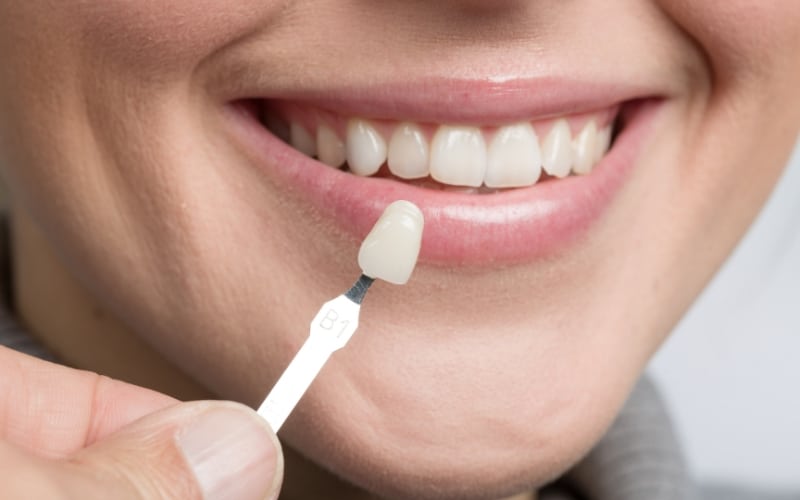 Cosmetic Dentistry - Advanced Solutions Family Dental, IL