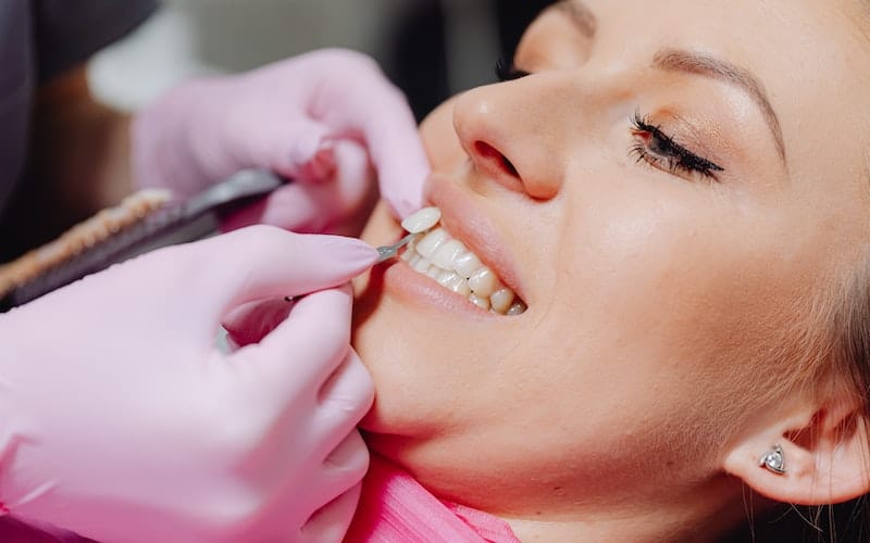 5 Common Misconceptions About Veneers Debunked