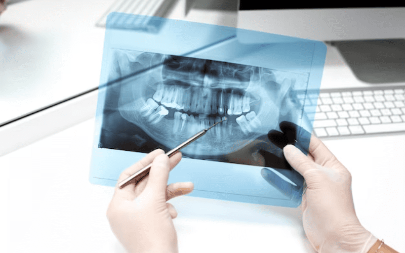 Dental Radiographs - Advanced Solutions Family Dental. IL