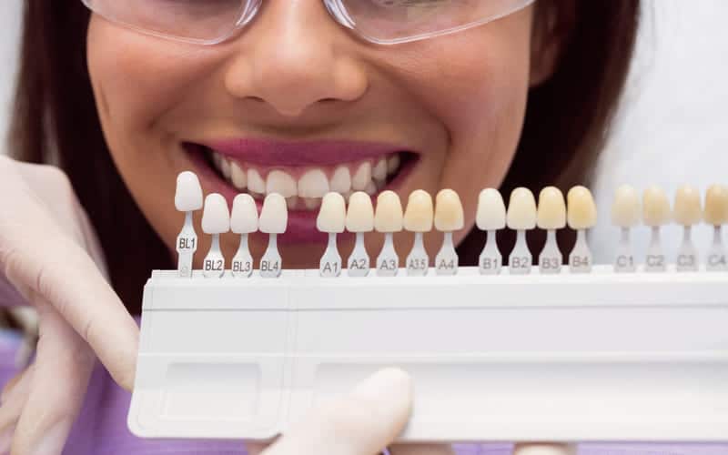 Dental Veneers - Advanced Solutions Family Dental, IL