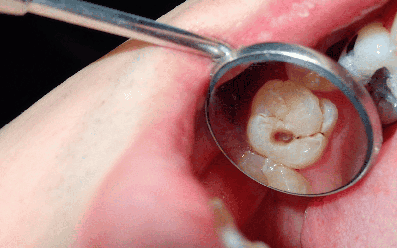 Dental Emergency - AS Family Dental