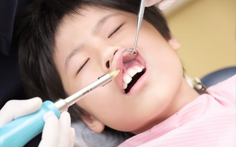 Why Is Anesthesia Necessary For Tooth Filling