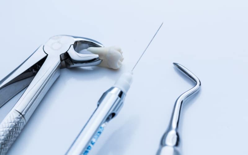 Tooth Extraction Without Anesthesia