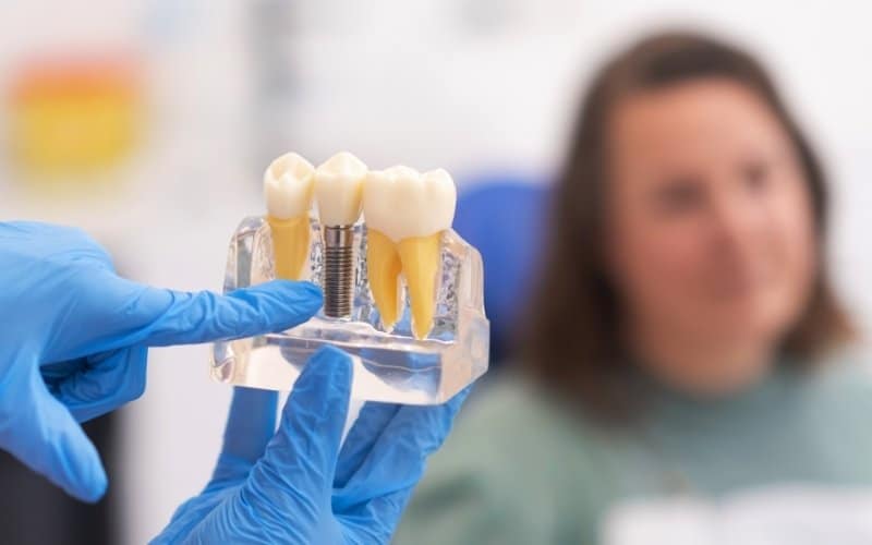 How Can Dental Implants Restore Your Smile?