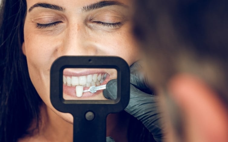 The Veneer Procedure: What to Expect During Your First Appointment?