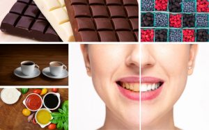 some foods that you must avoid once you get teeth whitening to get long-lasting results