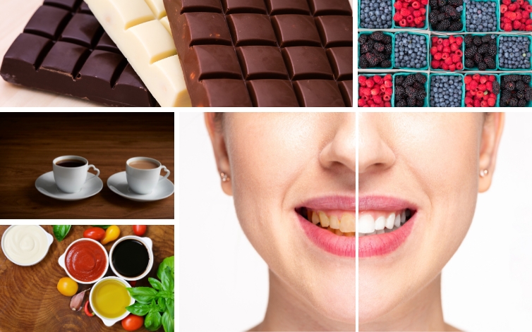 some foods that you must avoid once you get teeth whitening to get long-lasting results