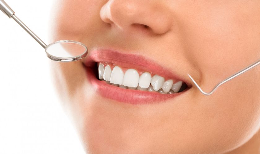 how long does teeth whitening last