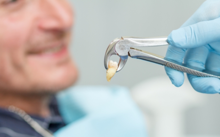 how many days you should take rest after tooth extraction