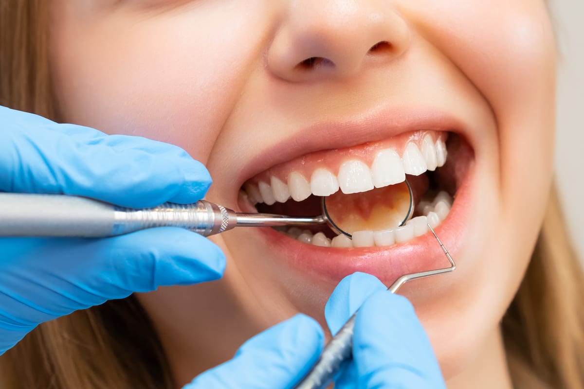 Periodontal Care in Oak Forest